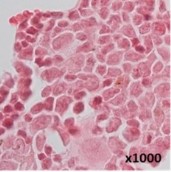PubMed